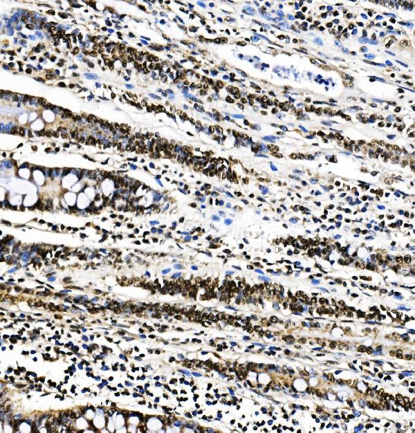 IHC - Anti-PTBP1 Antibody Picoband™(monoclonal, 3H12) ABO14913